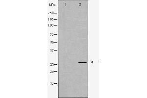 Western blot analysis of 293T whole cell lysates, using KLK7 Antibody. (Kallikrein 7 Antikörper  (Internal Region))