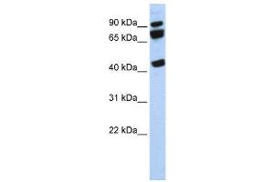 WB Suggested Anti-DDX17  Antibody Titration: 0. (DDX17 Antikörper  (N-Term))