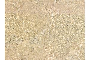 ABIN6262147 and ABIN6276755 at 1/100 staining human normal liver tissue by IHC-P.
