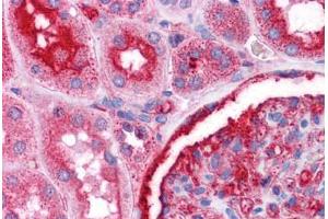 Immunohistochemistry (Formalin-fixed Paraffin-embedded Sections) (IHC (fp)) image for anti-Nuclear Receptor Subfamily 4, Group A, Member 2 (NR4A2) (N-Term) antibody (ABIN6745718)