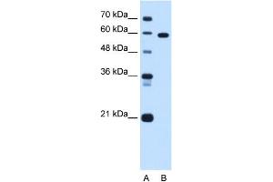 WB Suggested Anti-TBX15 Antibody Titration:  1. (T-Box 15 Antikörper  (C-Term))