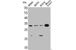 Western Blot analysis of SW480 SKOV3 BT474 mouse heart cells using FGF-18 Polyclonal Antibody (FGF18 Antikörper  (C-Term))