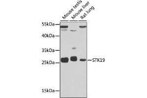 Western blot analysis of extracts of various cell lines, using STK19 antibody (ABIN6132689, ABIN6148598, ABIN6148600 and ABIN6217358) at 1:1000 dilution. (STK19 Antikörper  (AA 75-364))