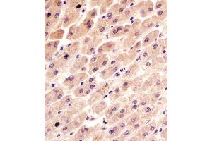 (ABIN6243360 and ABIN6577092) staining FER in human liver tissue sections by Immunohistochemistry (IHC-P - paraformaldehyde-fixed, paraffin-embedded sections). (FER Antikörper  (AA 1-300))