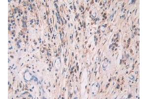 Immunohistochemistry (IHC) image for anti-Fibulin 1 (FBLN1) (AA 176-398) antibody (ABIN7434947)