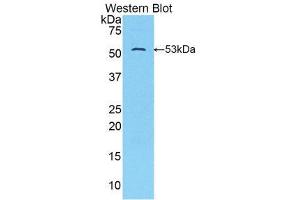 Western Blotting (WB) image for anti-Solute Carrier Family 2 (Facilitated Glucose Transporter), Member 14 (SLC2A14) (AA 51-105) antibody (ABIN1859032) (SLC2A14 Antikörper  (AA 51-105))