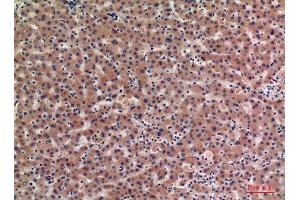 Immunohistochemistry (IHC) analysis of paraffin-embedded Human Liver, antibody was diluted at 1:100. (IGFBPI Antikörper  (Internal Region))