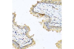 Immunohistochemistry of paraffin-embedded human prostate using DEFB121 antibody (ABIN5970550) at dilution of 1/100 (40x lens). (DEFB121 Antikörper)