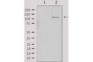 Western blot analysis of extracts from Hela, using MBTPS1 Antibody.