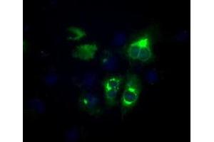 Image no. 2 for anti-Lipase, Endothelial (LIPG) antibody (ABIN1499165)