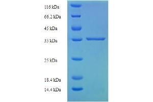 SDS-PAGE (SDS) image for Interleukin 29 (IL29) (AA 21-200), (partial) protein (His-SUMO Tag) (ABIN5711509)