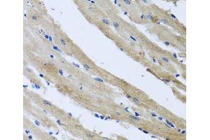 Immunohistochemistry of paraffin-embedded Rat heart using ST8SIA2 Polyclonal Antibody at dilution of 1:100 (40x lens). (ST8SIA2 Antikörper)