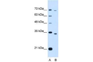 PHF6 antibody (20R-1278) used at 0. (PHF6 Antikörper  (Middle Region))