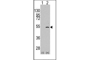 Image no. 1 for anti-Elongator complex protein 3 (ELP3) (C-Term) antibody (ABIN356662) (ELP3/KAT9 Antikörper  (C-Term))