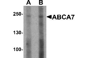 Western blot analysis of ABCA7 in 293 cell lysate with ABCA7 antibody at (A) 1 and (B) 2 µg/mL. (ABCA7 Antikörper  (N-Term))
