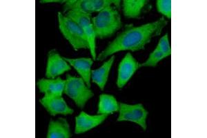 Immunofluorescence of human HeLa cells stained with Hoechst 33342 (Blue) and monoclonal anti-Hexokinase antibody (1:1000) with Alexa 488 (Green). (Hexokinase 1 Antikörper)