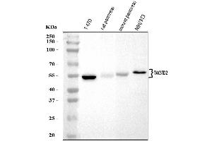 Western blot analysis of TROP2/TACSTD2 using anti-TROP2/TACSTD2 antibody (ABIN7603102). (TACSTD2 Antikörper  (Middle Region))
