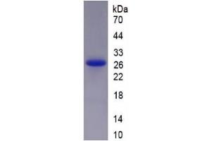 SDS-PAGE (SDS) image for Heat Shock Protein 27 (HSP27) ELISA Kit (ABIN6574189)