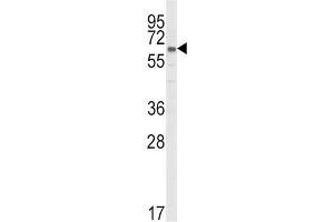 Western Blotting (WB) image for anti-Cytochrome P450, Family 51, Subfamily A, Polypeptide 1 (CYP51A1) antibody (ABIN3003944) (CYP51A1 Antikörper)