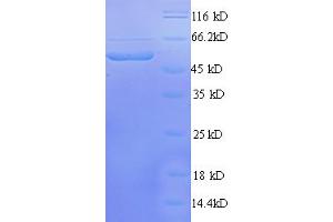 SDS-PAGE (SDS) image for Transcriptional Adaptor 3 (TADA3) (AA 1-238), (partial) protein (GST tag) (ABIN5712301)