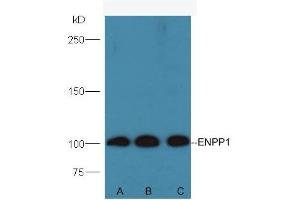 Lane A: Mouse testis lysates Lane B: Mouse kidney lysates Lane C: Mouse pancreas lysates. (ENPP1 Antikörper  (AA 41-140))