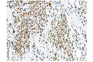 IHC analysis of NRF1 using anti-NRF1 antibody (ABIN7600874). (NRF1 Antikörper  (AA 246-503))