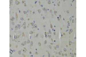 Immunohistochemistry of paraffin-embedded Mouse brain using RPL9 Polyclonal Antibody at dilution of 1:100 (40x lens). (RPL9 Antikörper)