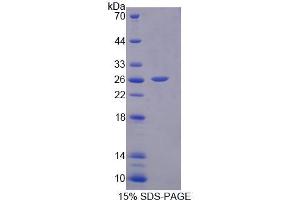 SDS-PAGE (SDS) image for Interleukin 17D (IL17D) (AA 76-274) protein (His tag) (ABIN6239142)