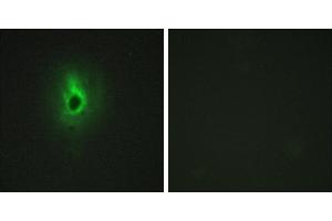 Peptide - +Immunohistochemistry analysis of paraffin-embedded human breast carcinoma tissue using Collagen VI α3 antibody. (COL6a3 Antikörper)