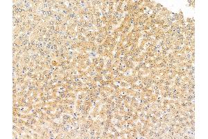 ABIN7094866 and ABIN7098918 at 1/100 staining Rat liver tissue by IHC-P. (SPRED2 Antikörper  (Internal Region))