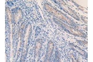 IHC-P analysis of Mouse Intestine Tissue, with DAB staining. (MGST1 Antikörper  (AA 8-155))