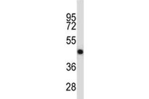 Western Blotting (WB) image for anti-Tumor Necrosis Factor Receptor Superfamily, Member 11b (TNFRSF11B) (AA 243-271) antibody (ABIN3029353)