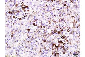 Immunohistochemistry (Paraffin-embedded Sections) (IHC (p)) image for anti-Microphthalmia-Associated Transcription Factor (MITF) (AA 351-450) antibody (ABIN676373)