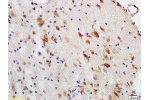 Formalin-fixed and paraffin embedded: rat brain tissue labeled with Anti-MBP Polyclonal Antibody , Unconjugated at 1:200, followed by conjugation to the secondary antibody and DAB staining (MBP Antikörper  (AA 69-85))