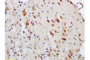 Formalin-fixed and paraffin embedded: rat brain tissue labeled with Anti-MBP Polyclonal Antibody , Unconjugated at 1:200, followed by conjugation to the secondary antibody and DAB staining (MBP Antikörper  (AA 69-85))