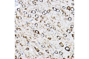 Immunohistochemistry of paraffin-embedded mouse brain using RPL17 Rabbit pAb (ABIN6128342, ABIN6147115, ABIN6147116 and ABIN6221632) at dilution of 1:100 (40x lens). (RPL17 Antikörper  (AA 1-184))