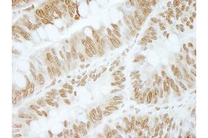 Immunohistochemistry (IHC) image for anti-Zinc Finger and BTB Domain Containing 40 (ZBTB40) (AA 1140-1190) antibody (ABIN7448873) (ZBTB40 Antikörper  (AA 1140-1190))