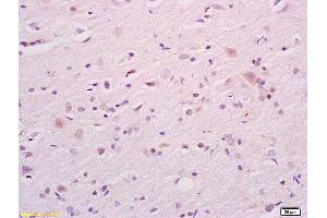 Formalin-fixed and paraffin embedded rat brain tissue labeled with Anti CKAP4 Polyclonal Antibody,Unconjugated (ABIN717506) at 1:200 followed by conjugation to the secondary antibody and DAB staining.