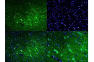 Formalin-fixed and paraffin embedded rat brain labeled with Rabbit Anti-Talin Polyclonal Antibody, FITC Conjugated at 1:200 for 60 minutes. (TLN1 Antikörper  (AA 1601-1750) (FITC))