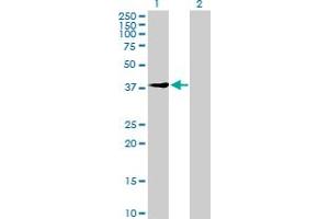 Western Blot analysis of UEVLD expression in transfected 293T cell line by UEVLD MaxPab polyclonal antibody. (UEVLD Antikörper  (AA 1-357))