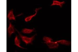 Immunofluorescence (fixed cells) (IF/ICC) image for anti-Potassium Large Conductance Calcium-Activated Channel, Subfamily M, beta Member 2 (KCNMB2) (Internal Region) antibody (ABIN6257763)