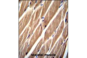 PIP5KL1 Antibody immunohistochemistry analysis in formalin fixed and paraffin embedded human skeletal muscle followed by peroxidase conjugation of the secondary antibody and DAB staining. (PIP5KL1 Antikörper  (N-Term))
