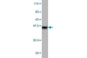 Western Blot detection against Immunogen (37. (Progesterone Receptor Antikörper  (AA 1-110))