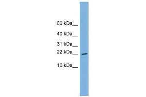 RPS13 antibody used at 1 ug/ml to detect target protein. (RPS13 Antikörper  (Middle Region))