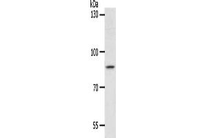 Gel: 8 % SDS-PAGE, Lysate: 40 μg, Lane: Hela cells, Primary antibody: ABIN7189809(ANKRD28 Antibody) at dilution 1/1050, Secondary antibody: Goat anti rabbit IgG at 1/8000 dilution, Exposure time: 2 hours (ANKRD28 Antikörper)