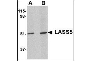 Western blot analysis of LASS5 in SK-N-SH lysate with this product at (A) 1 and (B) 2 μg/ml.