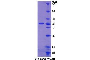 SDS-PAGE (SDS) image for Carnitine O-Octanoyltransferase (CROT) (AA 410-612) protein (His tag) (ABIN6238967) (CROT Protein (AA 410-612) (His tag))