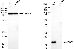 Western blotting analysis using DSTN antibody (ABIN7798319).