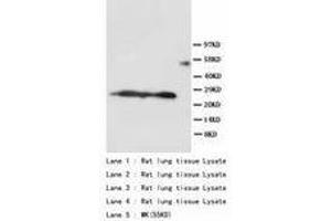 Image no. 1 for anti-Surfactant Protein A1 (SFTPA1) (AA 221-236) antibody (ABIN1493415) (Surfactant Protein A1 Antikörper  (AA 221-236))