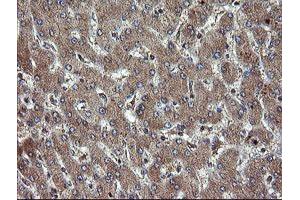 Immunohistochemical staining of paraffin-embedded Human liver tissue using anti-TBCC mouse monoclonal antibody. (TBCC Antikörper)